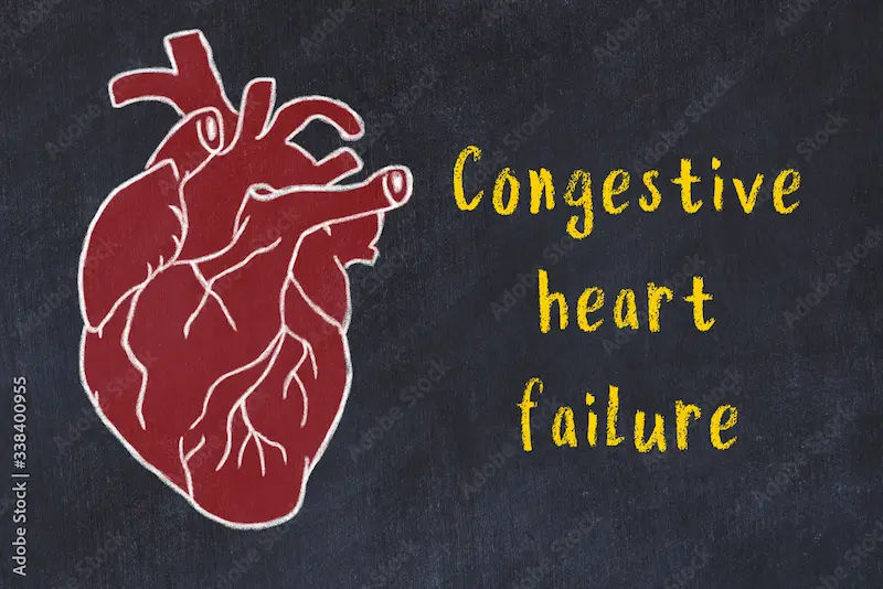 Congestive Heart Failure Causes, Symptoms, and Modern Treatments